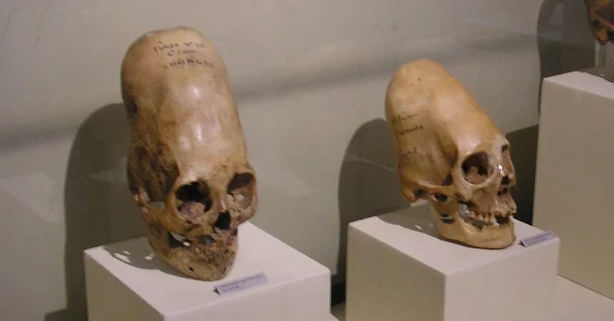 Elongated Skulls & Ica Stones - 1